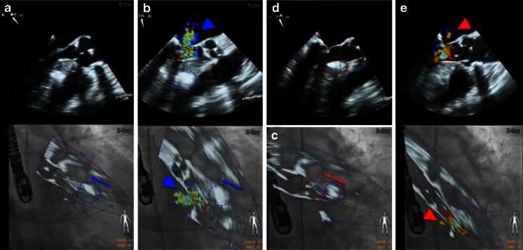 Fig. 14