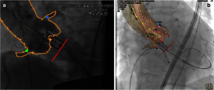 Fig. 11