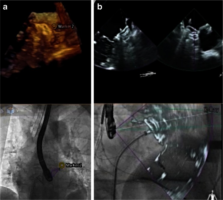 Fig. 13