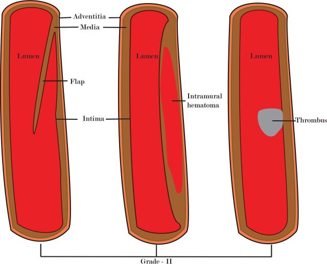 Fig 3.