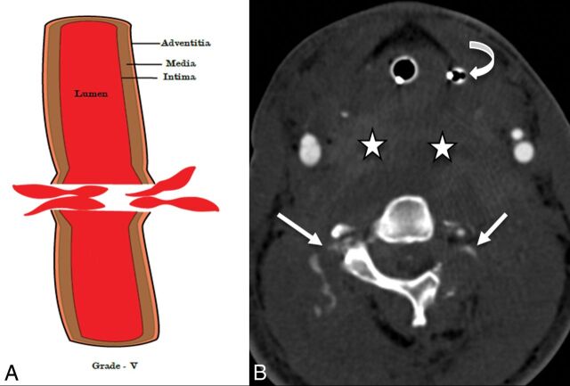 Fig 8.