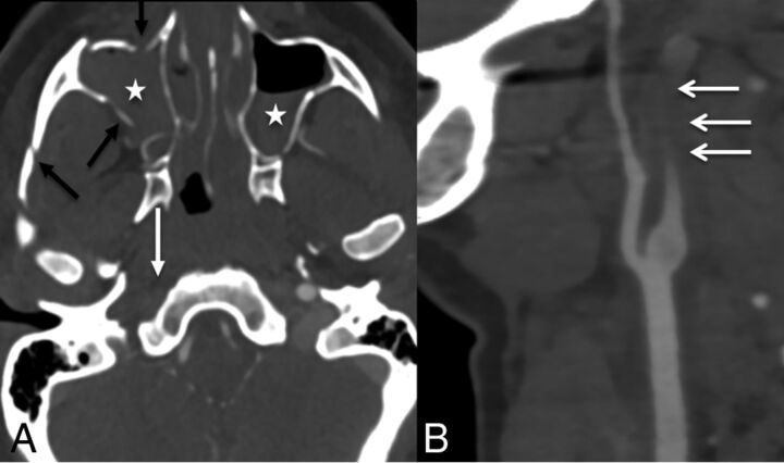 Fig 7.