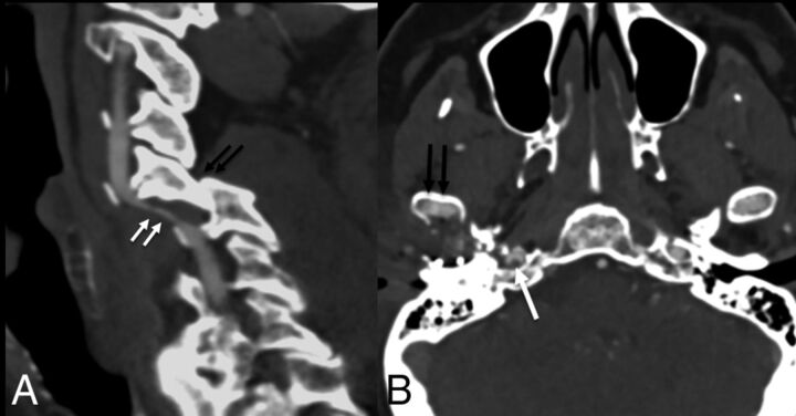 Fig 4.