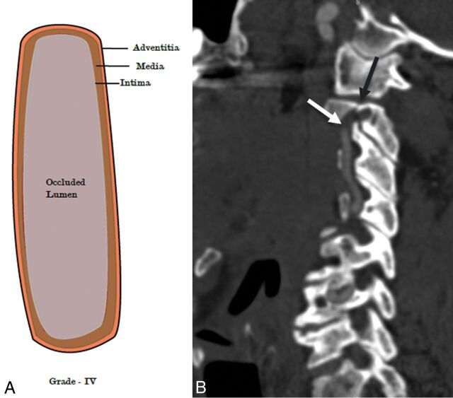 Fig 6.