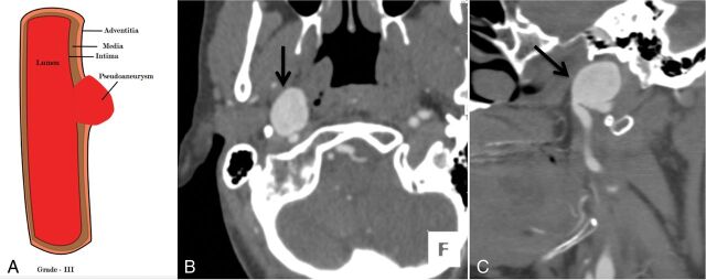 Fig 5.