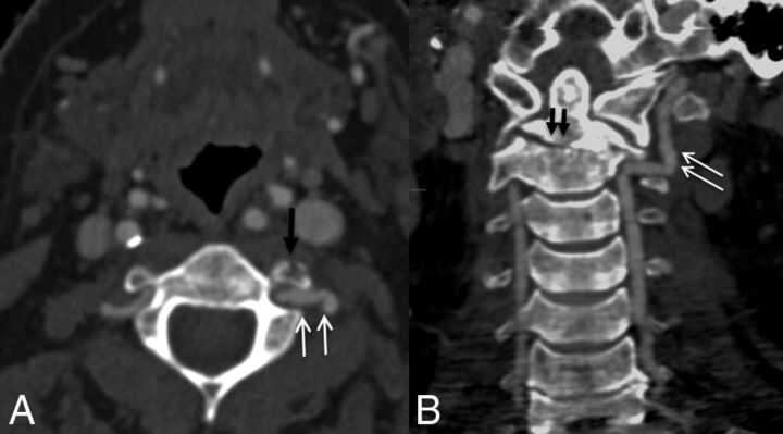 Fig 2.