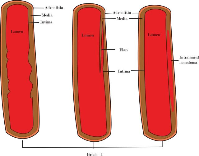 Fig 1.