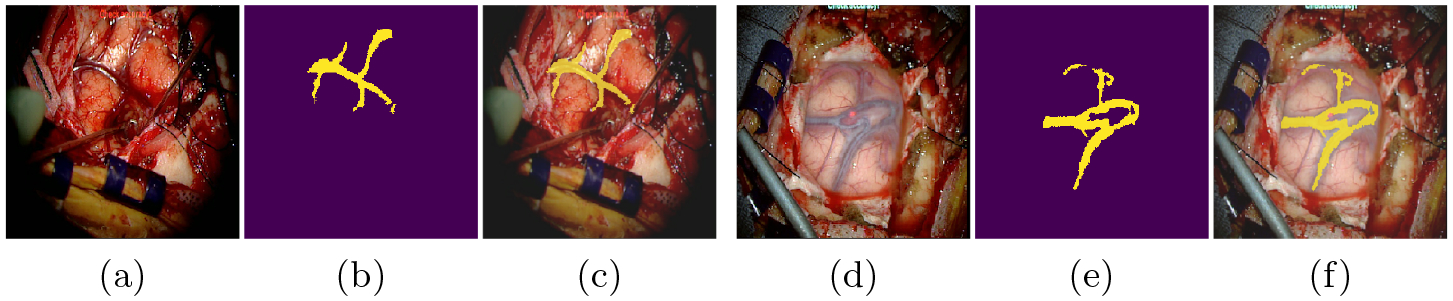 Fig. 2: