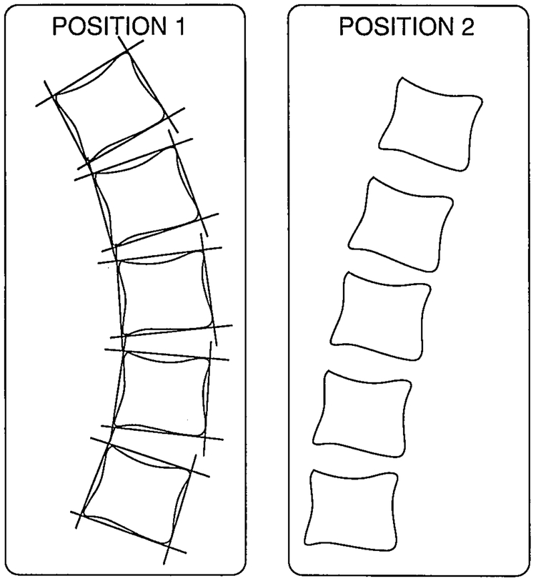 Fig 1.