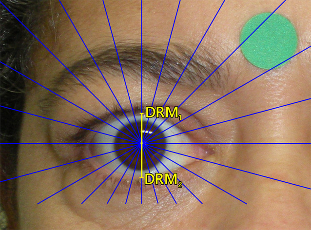 Fig. 2