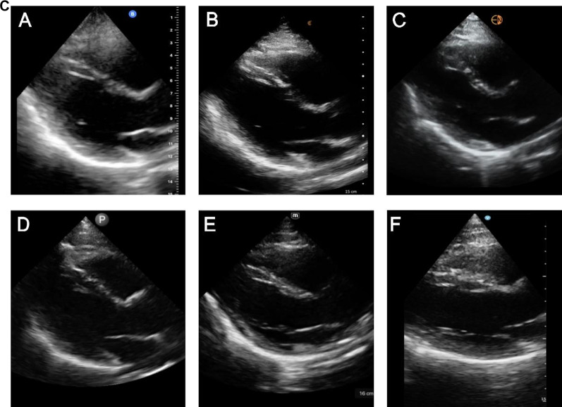 Fig. 3