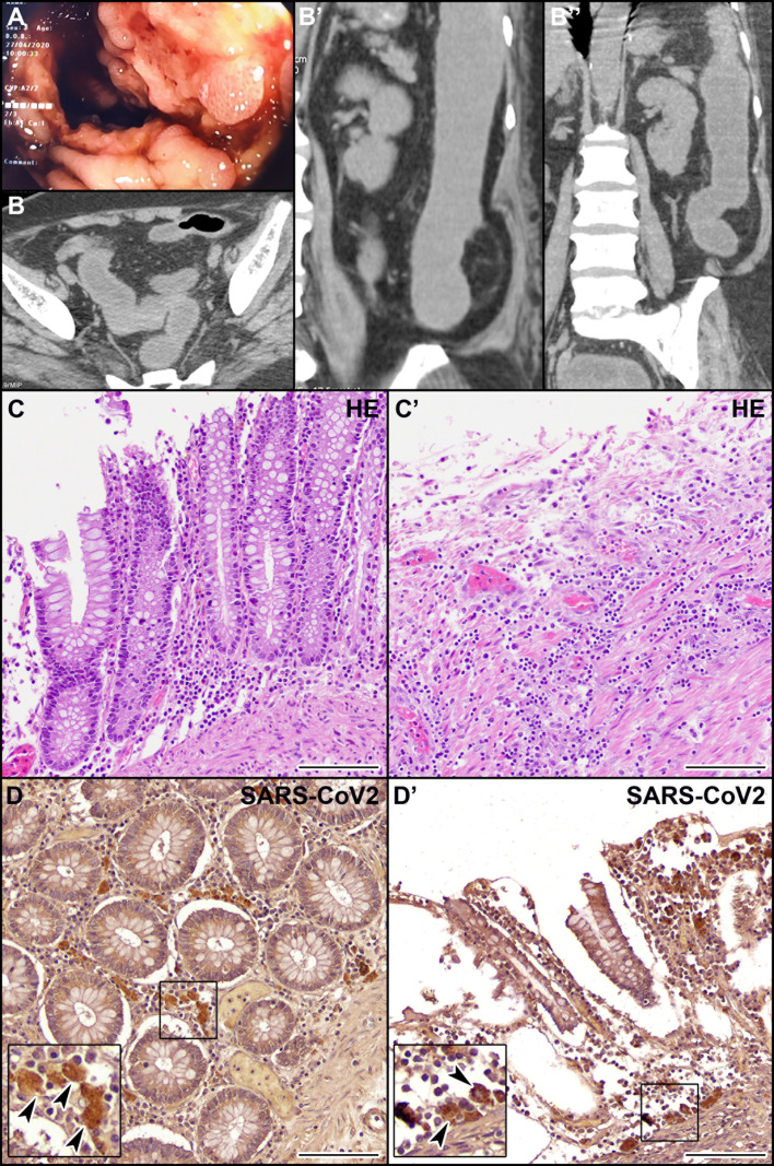 Figure 2