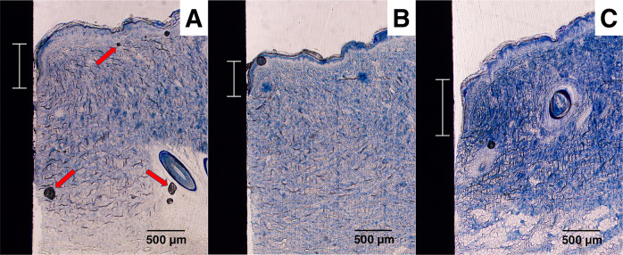 Fig. 13