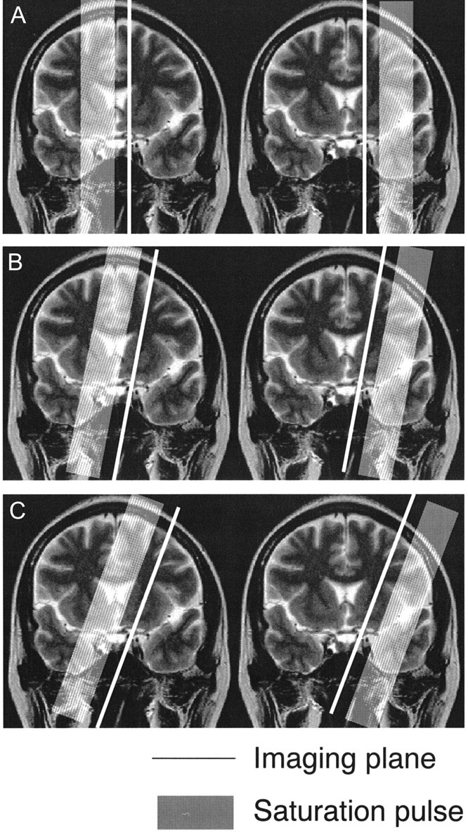 Fig 1.