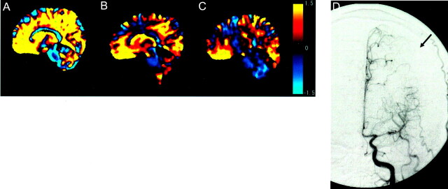 Fig 3.