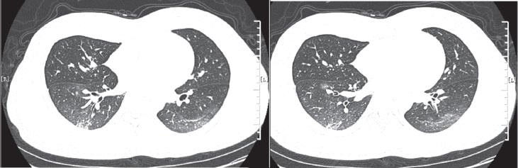 Fig. 5