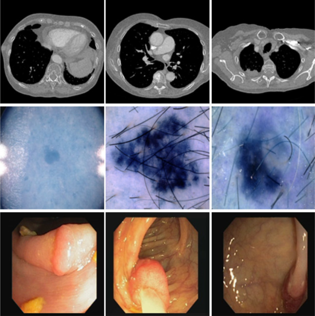 Fig. 1