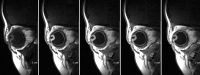 Fig 3.