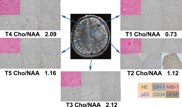 Fig. 2