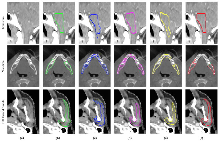 Fig. 10