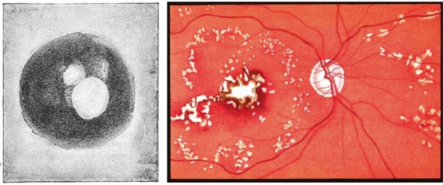 Fig. 13