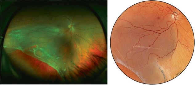 Fig. 16