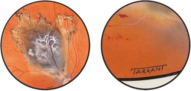 Fig. 12