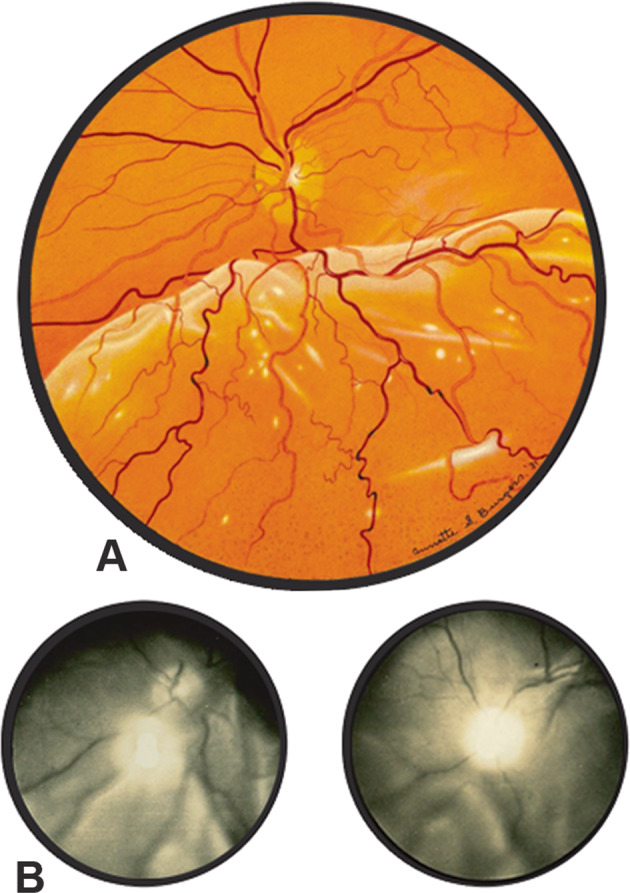 Fig. 14