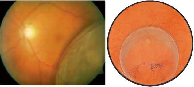 Fig. 15