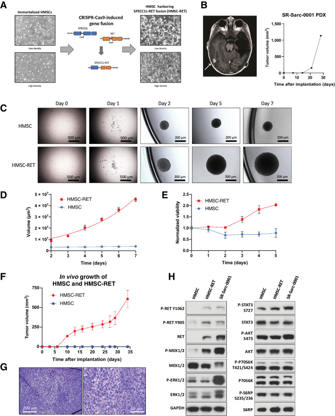 Figure 1. Establishment of novel SPECC1L-RET–rearranged sarcoma models. A, Generation of a SPECC1L-RET chromosomal rearrangement using CRISPR-Cas9–mediated genomic engineering in immortalized HMSC. B, Imaging of the brain metastasis of the SPECC1L-RET–rearranged sarcoma (left) that was used to establish SR-Sarc-0001 PDX (PDX growth in time is depicted in the right panel) C, HMSC and HMSC-RET cells were plated into ultra-low attachment plates to form spheroids and images were captured every 24 hours. Data represent the mean ± SD of 10 measurements. D, Spheroid volume. E, Metabolic activity of the spheroids was measured every 24 hours using alamarBlue cell viability dye. Resulting values were normalized to the initial values obtained at the first measurement (24 hours after seeding). Data represent mean ± SD of 12 measurements. F, HMSCs and HMSC-RET cells were implanted subcutaneously (10 million cells per implantation) to assess tumorigenesis. All HMSC-RET implantations resulted in tumors (100% penetrance), while HMSCs did not form tumors. Data represent the mean ± SD of 4 tumors. G, HMSC-RET xenografts were extracted, fixed in formalin, and embedded in paraffin. Hematoxylin and eosin staining of the obtained tissue slides is shown. H, HMSC, HMSC-RET, and SR-Sarc-0001 cells were serum-starved for 24 hours and then whole-cell extracts were prepared for Western blot profiling for the total and phosphorylated proteins shown.