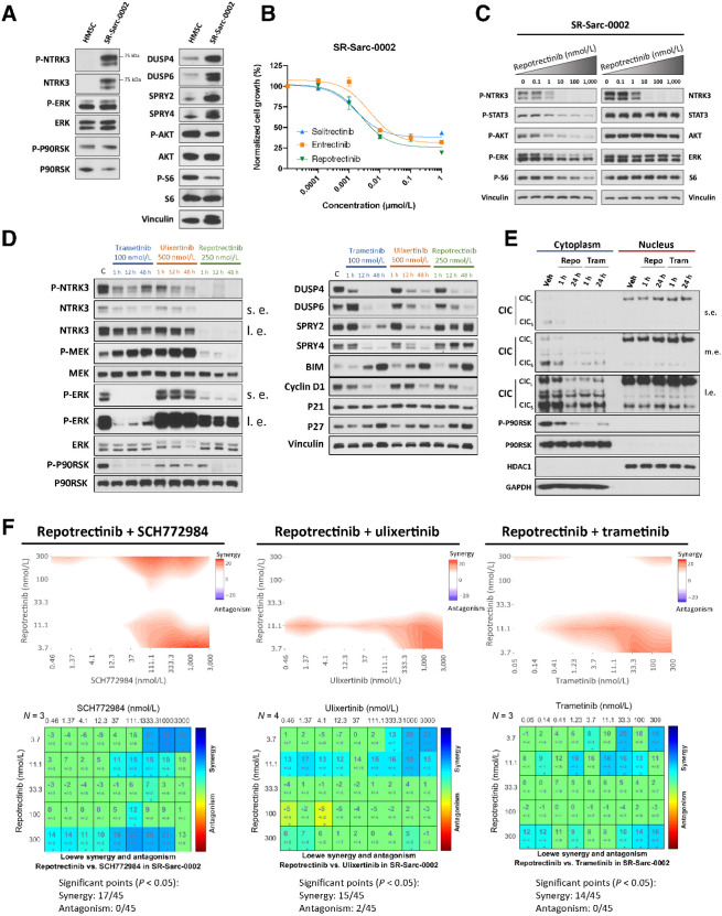 Figure 8. ETV6-NTRK3–rearranged sarcoma model confirms a broad role of MAPK regulation in RTK oncogenesis and response to therapy. A, HMSC and SR-Sarc-0002 (ETV6-NTRK3F617I–rearranged infantile fibrosarcoma cell line) cells were serum-starved for 24 hours and then whole-cell extracts were prepared for Western blot profiling. B, SR-Sarc-0002 cell were treated with the indicated doses of repotrectinib (TPX-0005), entrectinib, and selitrectinib (LOXO-195) for 96 hours and then cell viability was assessed using alamarBlue. Data represent the mean ± SD of three measurements. C, SR-Sarc-0002 cells were treated with the indicated doses of repotrectinib for 90 minutes and then whole-cell extracts were prepared for Western blot profiling. D, SR-Sarc-0002 cells were treated with trametinib (100 nmol/L), ulixertinib (500 nmol/L), or repotrectinib (250 nmol/L) for the indicated times and then whole-cell extracts prepared for Western blotting. s.e., shorter exposure; l.e., longer exposure. E, SR-Sarc-0002 cells were treated with repotrectinib (250 nmol/L) or trametinib (100 nmol/L) for 1 and 24 hours and nuclear and cytoplasmic extracts were prepared for Western blotting. Repo, repotrectinib 250 nmol/L; Tram, trametinib 100 nmol/L; m.e., medium exposure. F, SR-Sarc-0002 cells were treated with the indicated combinations of repotrectinib and SCH772984 (left), repotrectinib and ulixertinib (middle), and repotrectinib and trametinib (right) for 96 hours and then cell viability was determined. Loewe synergy analysis was applied to determine the synergy scores and their statistical significance for each combination. Resulting scores are shown as a contour map (top) or a matrix table (bottom). Representative immunoblots from two independent experiments are shown in A, C, D, E.