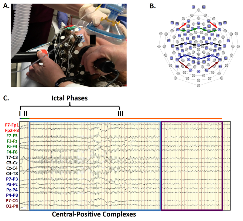 FIGURE 1: