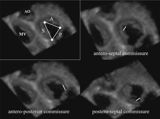 Fig. 4