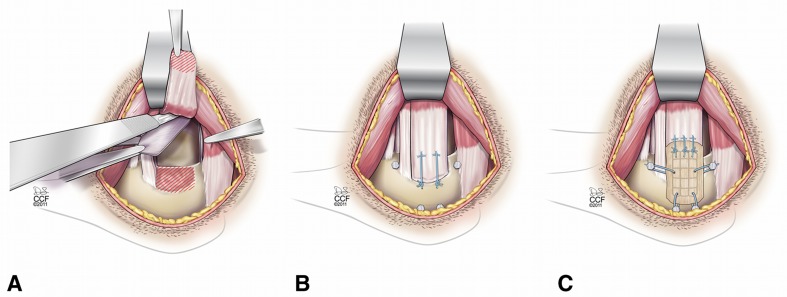 Fig. 1A–C