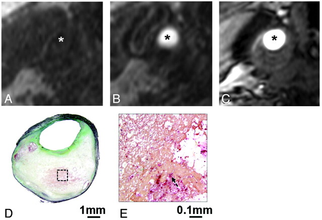 Fig 4.