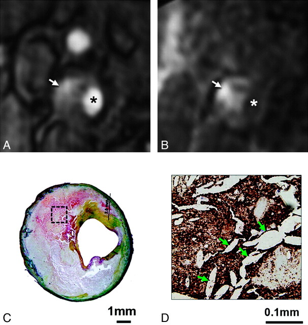 Fig 3.