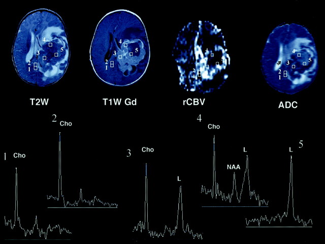 Fig 2.