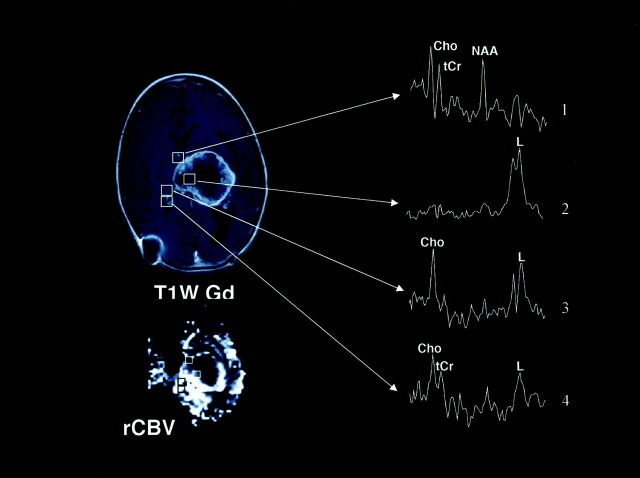 Fig 6.