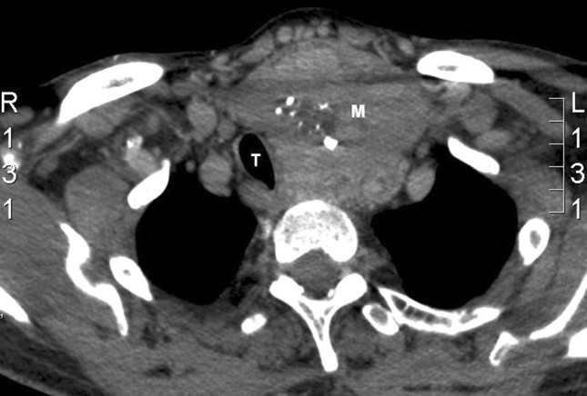 Fig. 2