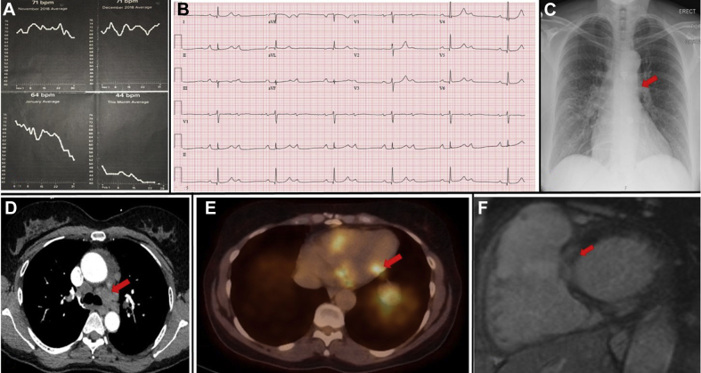 Figure 1