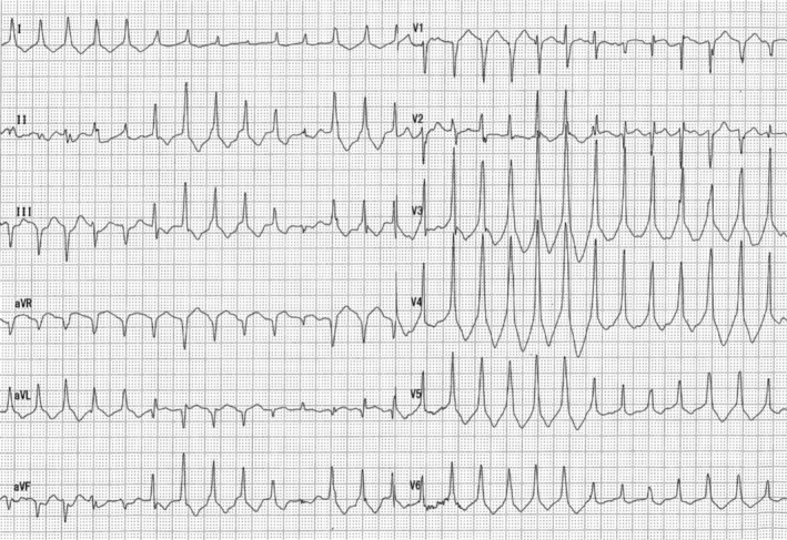 FIGURE 1