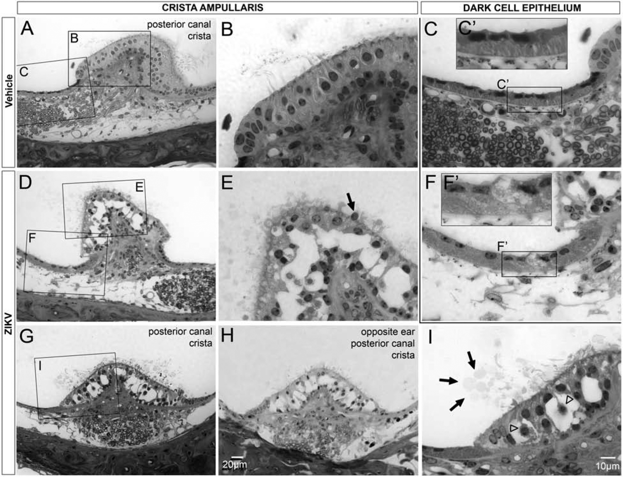 Figure 11.