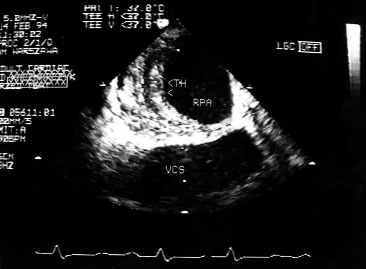 Figure 3  