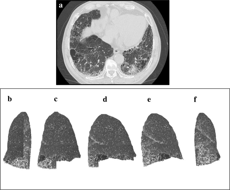 Fig 5