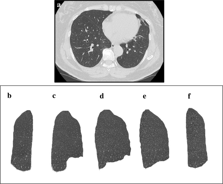 Fig 3