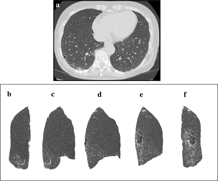 Fig 4