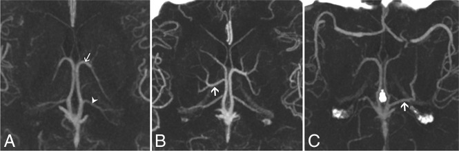 Fig 3.