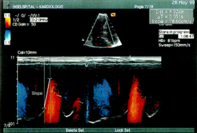 Figure 2  