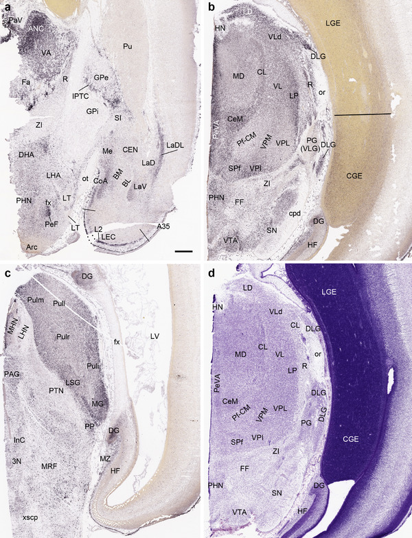 FIGURE 14