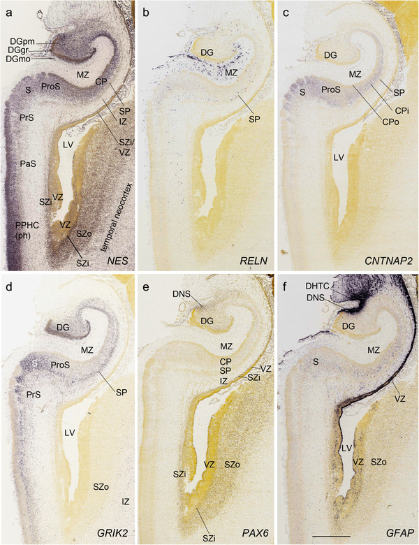 FIGURE 9